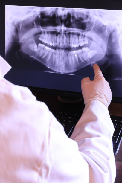 Best Emergency Root Canal Treatment in Dyer, IN