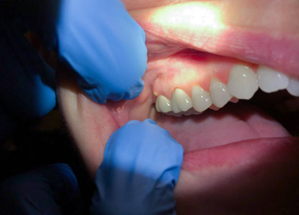 Best Emergency Dental Care for Trauma or Injury in Dyer, IN