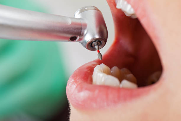Best Emergency Treatment for Toothache in Dyer, IN